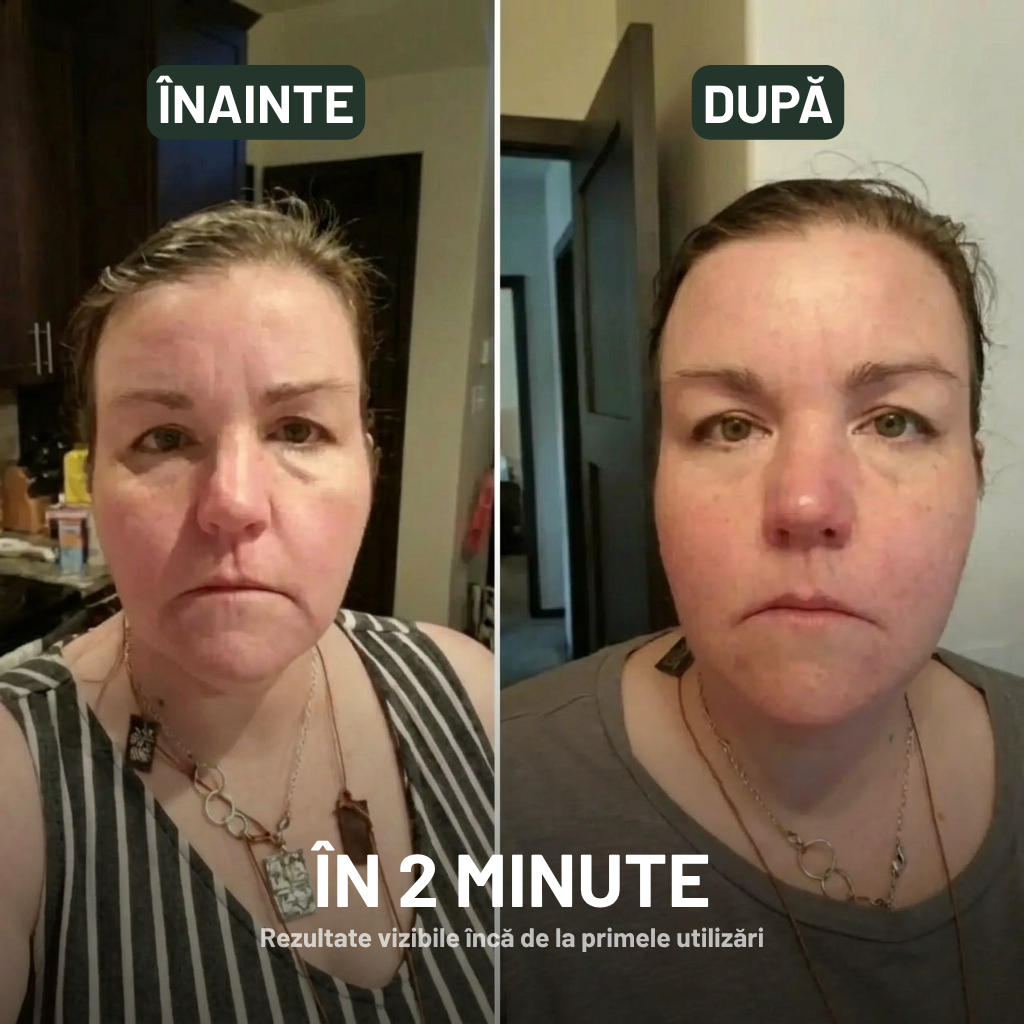 Veldonia | Perie pentru masaj limfatic facial